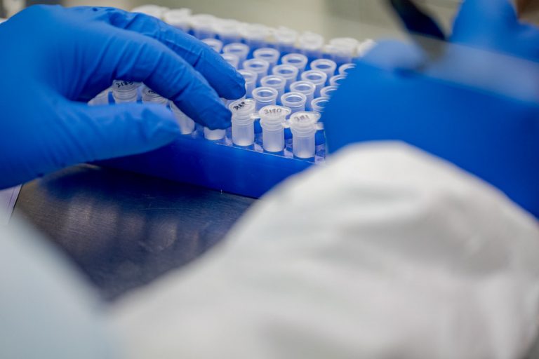 photo of medical test vials